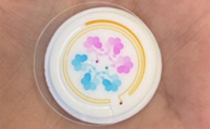 Imagen: el sensor de sudor microfluídico 3D de próxima generación rastrea cambios rápidos de biomarcadores con alta precisión (Foto cortesía de Da Som Yang/Universidad Chung-Ang)